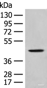 Western blot analysis of A549 cell lysate using HLA-B Polyclonal Antibody at dilution of 1:400