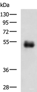 Western blot analysis of Human colorectal cancer tissue lysate using METTL17 Polyclonal Antibody at dilution of 1:700