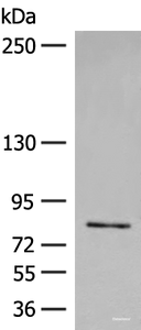 Western blot analysis of Jurkat cell lysate using FGD3 Polyclonal Antibody at dilution of 1:500