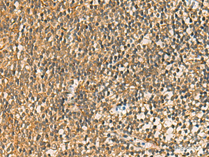 Immunohistochemistry of paraffin-embedded Human tonsil tissue using FAAP100 Polyclonal Antibody at dilution of 1:50 (×200)