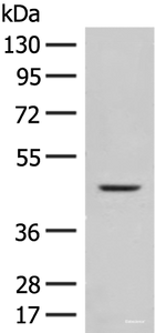 Western blot analysis of Mouse liver tissue lysate using FUT10 Polyclonal Antibody at dilution of 1:450