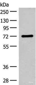 Western blot analysis of Rat brain tissue lysate using SLC6A11 Polyclonal Antibody at dilution of 1:500