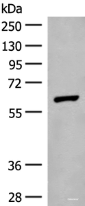 Western blot analysis of Mouse liver tissue lysate using GLS2 Polyclonal Antibody at dilution of 1:400