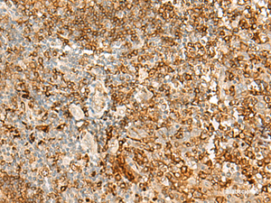 Immunohistochemistry of paraffin-embedded Human tonsil tissue using HLA-DRB1 Polyclonal Antibody at dilution of 1:35 (×200)