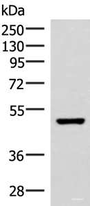 Western blot analysis of Mouse brain tissue lysate using IP6K2 Polyclonal Antibody at dilution of 1:500