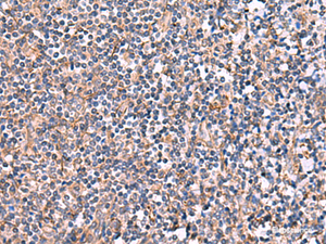 Immunohistochemistry of paraffin-embedded Human tonsil tissue using INPP5B Polyclonal Antibody at dilution of 1:40 (×200)