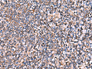 Immunohistochemistry of paraffin-embedded Human tonsil tissue using INSC Polyclonal Antibody at dilution of 1:65 (×200)