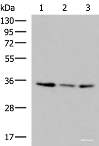 Western blot analysis of HepG2 HL60 cell Human fetal liver tissue lysates using ISY1-RAB43 Polyclonal Antibody at dilution of 1:1000