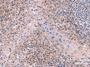 Immunohistochemistry of paraffin-embedded Human tonsil tissue using ITIH4 Polyclonal Antibody at dilution of 1:50 (×200)