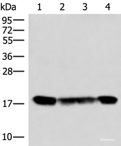 Western blot analysis of 293T and 231 cell lysates using PEMT Polyclonal Antibody at dilution of 1:800