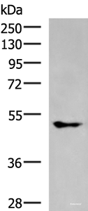 Western blot analysis of A549 cell lysate using KCNJ2 Polyclonal Antibody at dilution of 1:550