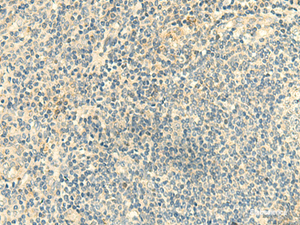 Immunohistochemistry of paraffin-embedded Human tonsil tissue using CLEC10A Polyclonal Antibody at dilution of 1:50 (×200)