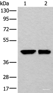 Western blot analysis of HEPG2 and 231 cell lysates using DLK1 Polyclonal Antibody at dilution of 1:250