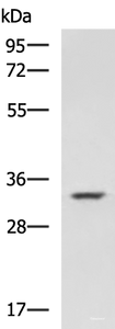 Western blot analysis of A549 cell lysate using HMOX1 Polyclonal Antibody at dilution of 1:800