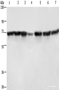 Western blot analysis of Hela cells HT29 cells human fetal liver tissue Human testis tissue 231 cells K562 cells human bladder transitional cell carcinoma tissue using LMNB1 Polyclonal Antibody at dilution of 1:750