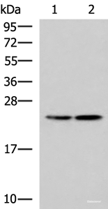 Western blot analysis of A549 and A172 cell lysates using RGS2 Polyclonal Antibody at dilution of 1:1350