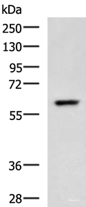 Western blot analysis of A549 cell lysate using TERF1 Polyclonal Antibody at dilution of 1:400