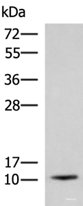 Western blot analysis of Human fetal brain tissue lysate using ACYP1 Polyclonal Antibody at dilution of 1:700