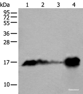 Western blot analysis of Human heart tissue Mouse heart tissue Rat heart tissue and Human muscle tissue lysates using MB Polyclonal Antibody at dilution of 1:400