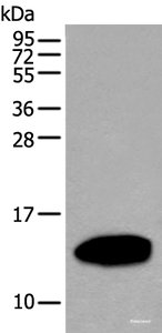 Western blot analysis of Human pancreas tissue lysate using REG1A Polyclonal Antibody at dilution of 1:500