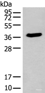 Western blot analysis of HEPG2 cell lysate using ACBD4 Polyclonal Antibody at dilution of 1:400