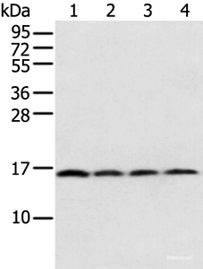 Western blot analysis of 231 Hela K562 cell and Human bladder carcinoma tissue using MRPS18C Polyclonal Antibody at dilution of 1:800