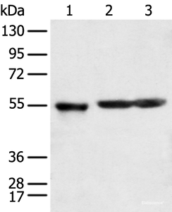 Western blot analysis of Human cerebrum tissue rat brain tissue and Mouse brain tissue using KCTD16 Polyclonal Antibody at dilution of 1:350