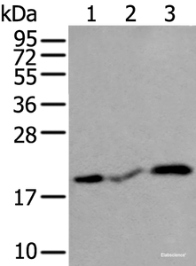 Western blot analysis of Human heart tissue Rat heart tissue and Mouse heart tissue lysates using CSRP3 Polyclonal Antibody at dilution of 1:400