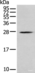 Western blot analysis of K562 cell using MOB1B Polyclonal Antibody at dilution of 1:250