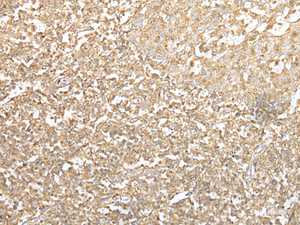 Immunohistochemistry of paraffin-embedded Human tonsil tissue using SPIC Polyclonal Antibody at dilution of 1:55 (×200)