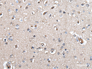 Immunohistochemistry of paraffin-embedded Human brain tissue using UMPS Polyclonal Antibody at dilution of 1:40 (×200)