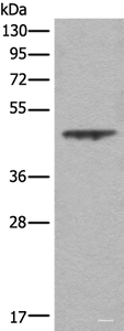 Western blot analysis of A431 cell lysate using ASS1 Polyclonal Antibody at dilution of 1:350