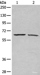 Western blot analysis of A431 and Hela cell lysates using ATAD3A Polyclonal Antibody at dilution of 1:500