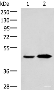 Western blot analysis of Human fetal liver tissue and Human liver tissue lysates using BHMT2 Polyclonal Antibody at dilution of 1:800