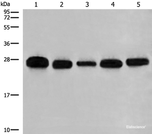 Western blot analysis of 293T A549 Hela K562 and HEPG2 cell lysates using GATD3B Polyclonal Antibody at dilution of 1:400