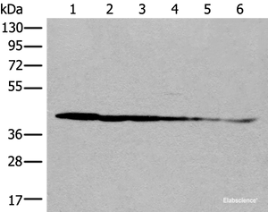 Western blot analysis of Rat brain tissue Human cerebrum tissue Human fetal brain tissue Hela cell Human breast cancer tissue Jurkat cell lysates using PITPNB Polyclonal Antibody at dilution of 1:500