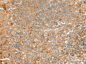 Immunohistochemistry of paraffin-embedded Human tonsil tissue using ASMTL Polyclonal Antibody at dilution of 1:100 (×200)