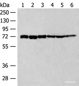 Western blot analysis of 293T cell Human fetal brain tissue Jurkat cell Hela cell Mouse heart tissue lysates using TCF25 Polyclonal Antibody at dilution of 1:250