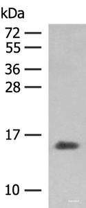 Western blot analysis of Human plasma solution using HBG1:HBG2 Polyclonal Antibody at dilution of 1:250
