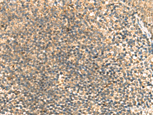 Immunohistochemistry of paraffin-embedded Human tonsil tissue using TCAP Polyclonal Antibody at dilution of 1:55 (×200)