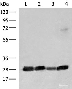 Western blot analysis of 231 K562 Jurkat and Raji cell lysates using CD48 Polyclonal Antibody at dilution of 1:550