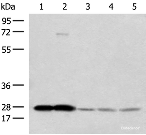 Western blot analysis of Human cerebella tissue Human cerebrum tissue Human skin tissue NIH/3T3 cell SKOV3 cell lysates using OVOL2 Polyclonal Antibody at dilution of 1:350