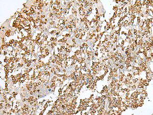 Immunohistochemistry of paraffin-embedded Human tonsil tissue using SEPT1 Polyclonal Antibody at dilution of 1:50 (×200)
