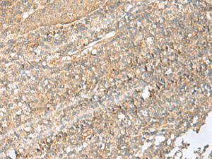 Immunohistochemistry of paraffin-embedded Human tonsil tissue using NID2 Polyclonal Antibody at dilution of 1:70 (×200)