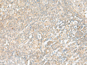 Immunohistochemistry of paraffin-embedded Human tonsil tissue using BEX2 Polyclonal Antibody at dilution of 1:45 (×200)