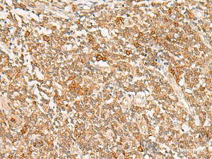 Immunohistochemistry of paraffin-embedded Human tonsil tissue using JPT1 Polyclonal Antibody at dilution of 1:35 (×200)