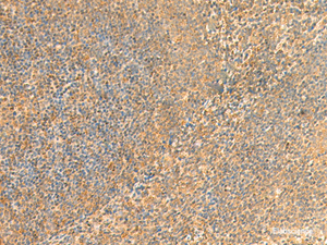 Immunohistochemistry of paraffin-embedded Human tonsil tissue using UBD Polyclonal Antibody at dilution of 1:50 (×200)