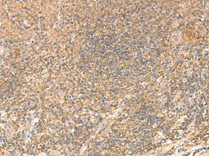 Immunohistochemistry of paraffin-embedded Human tonsil tissue using PDAP1 Polyclonal Antibody at dilution of 1:50 (×200)