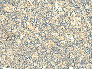 Immunohistochemistry of paraffin-embedded Human tonsil tissue using TMEM9 Polyclonal Antibody at dilution of 1:50 (×200)