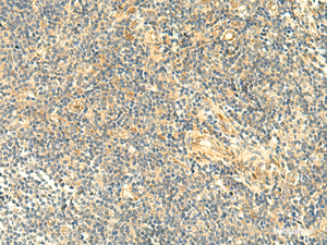 Immunohistochemistry of paraffin-embedded Human tonsil tissue using ASB6 Polyclonal Antibody at dilution of 1:50 (×200)